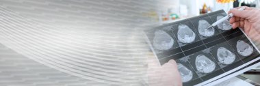 MR taramasını analiz eden doktor, panoramik pankart