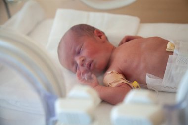Hastanede prematüre yeni doğmuş bebek. Yenidoğan yoğun bakım ünitesi 