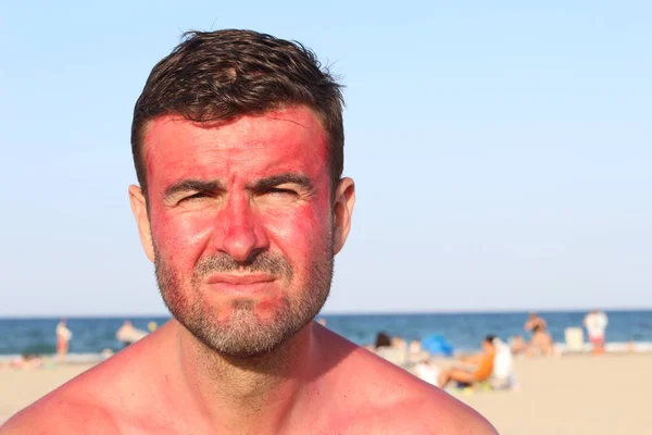 Uomo Che Scotta Sole Spiaggia — Foto Stock