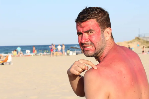 Uomo Che Scotta Sole Spiaggia — Foto Stock