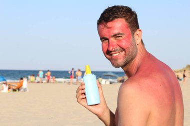 Man getting sunburned at beach clipart