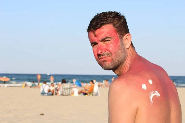 Чоловік Загорівся Пляжі — стокове фото