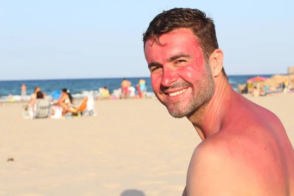Man Getting Sunburned Beach — Stock Photo, Image