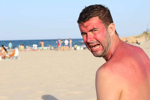 Uomo Che Scotta Sole Spiaggia — Foto Stock