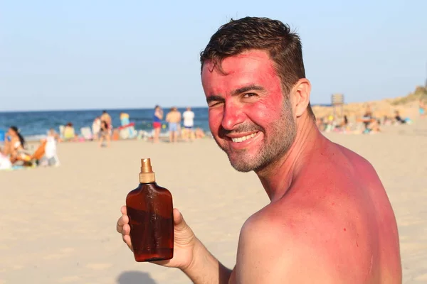 Man Wordt Verbrand Het Strand — Stockfoto