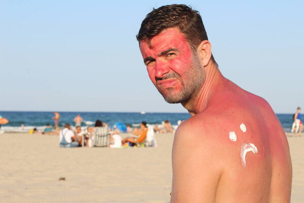 Man getting sunburned at beach