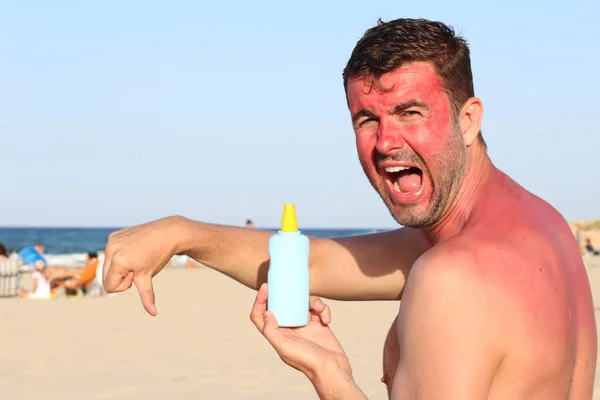 Homem Ficando Queimado Sol Praia — Fotografia de Stock