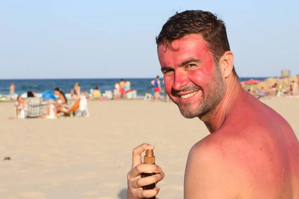 Mann Bekommt Strand Sonnenbrand — Stockfoto