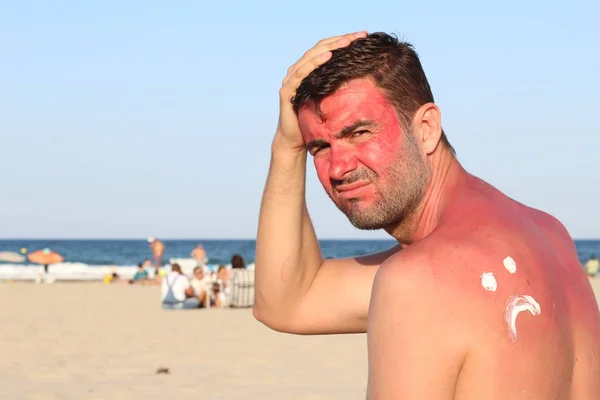 Man getting sunburned at beach
