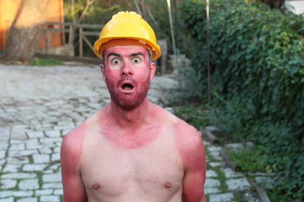 Zonverbrande Jongeman Met Extreme Bruine Lijnen — Stockfoto