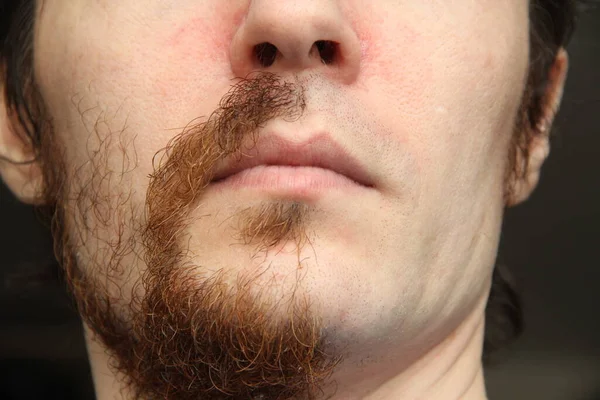 Yüzünün alt kısmı beyaz bir adamın. Yüzün yarısı tıraş olmuş, diğer yarısı bıyıklı ve sakallı.