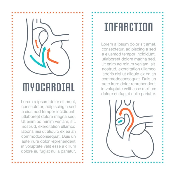 Site Web Bannière et page d'atterrissage de l'infarctus du myocarde . — Image vectorielle