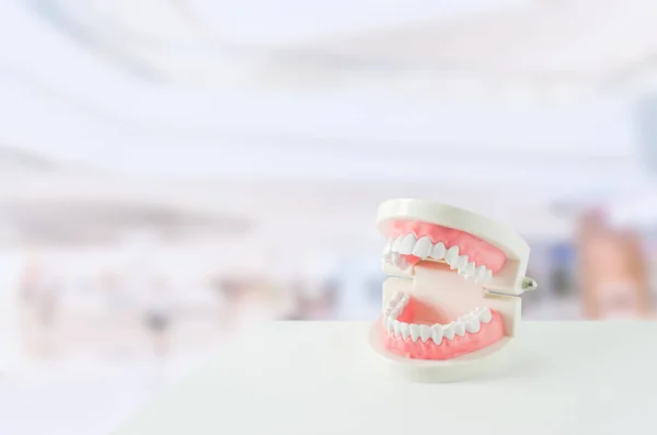 Zbliżenie Białego Modelu Zębów Czerwoną Gumą Lustrem Dentystycznym Rozmytym Tle — Zdjęcie stockowe