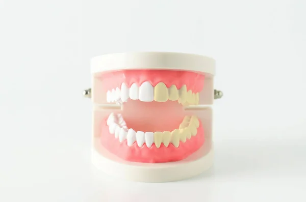 Close White Yellow Teeth Model Red Gum White Background — Stock Photo, Image