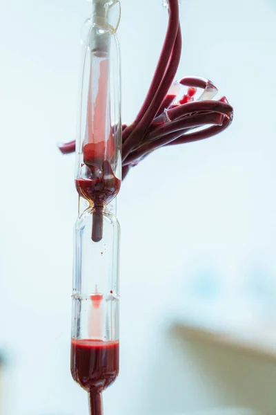 Zavřít Trubice Transfúze Krve Pro Pacienta — Stock fotografie