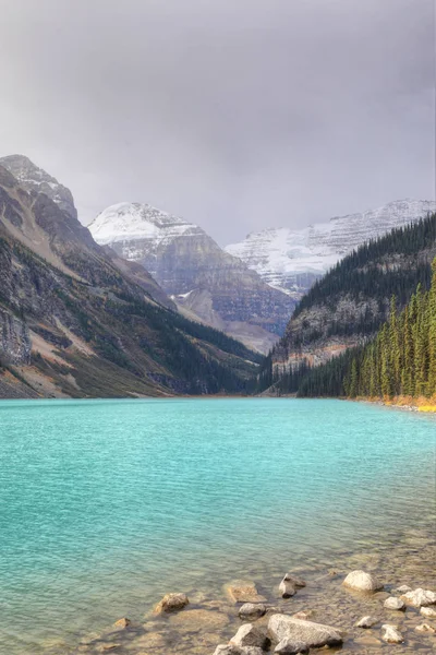 Pionowe Lake Louise w Parku Narodowym Banff, Kanada — Zdjęcie stockowe