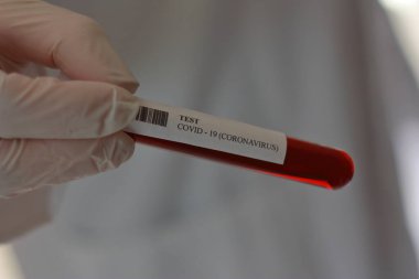 Wuhan Coronavirus Testi. Covid 19. Çin Köken Virüsleri.