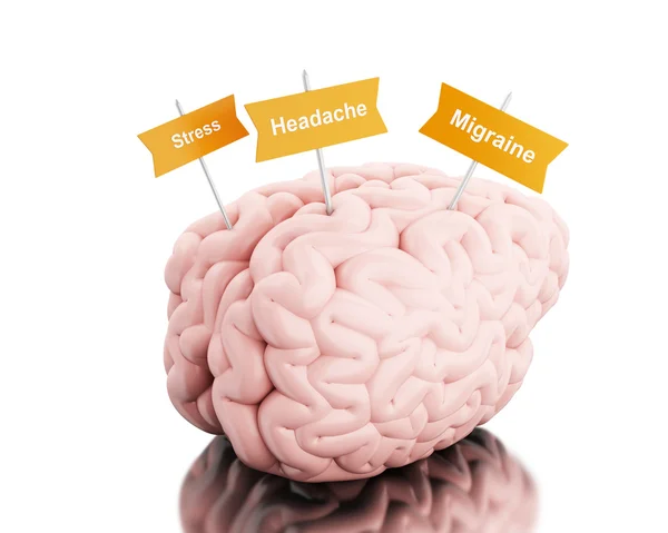 3d Brain with signboards of various head pains. — Stock Photo, Image