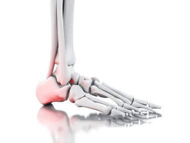 3D acı ayak bileği