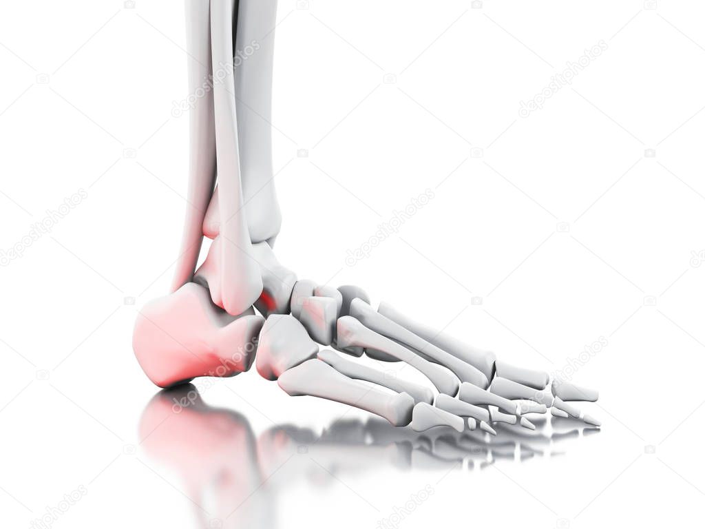 3d Painful ankle