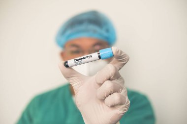 Coronavirus 2019 nCoV kan örneği. Corona virüsü salgını. Laboratuvardaki Corona Virüsü. Bilim adamları üzerinde kan testi olan bir tüp ve virüsün adı Coronavirus olan bir barkod tutuyor. Yeni Salgın Corona Virüsü