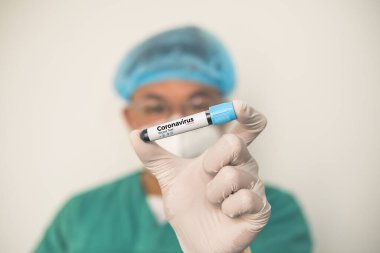 Coronavirus 2019 nCoV kan örneği. Corona virüsü salgını. Laboratuvardaki Corona Virüsü. Bilim adamları üzerinde kan testi olan bir tüp ve virüsün adı Coronavirus olan bir barkod tutuyor. Yeni Salgın Corona Virüsü