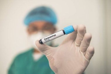 Coronavirus 2019 nCoV kan örneği. Corona virüsü salgını. Laboratuvardaki Corona Virüsü. Bilim adamları üzerinde kan testi olan bir tüp ve virüsün adı Coronavirus olan bir barkod tutuyor. Yeni Salgın Corona Virüsü