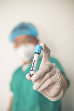 Coronavirus 2019 nCoV kan örneği. Corona virüsü salgını. Laboratuvardaki Corona Virüsü. Bilim adamları üzerinde kan testi olan bir tüp ve virüsün adı Coronavirus olan bir barkod tutuyor. Yeni Salgın Corona Virüsü