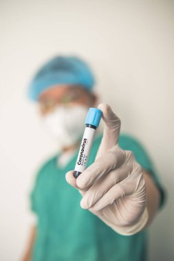 Coronavirus 2019 nCoV kan örneği. Corona virüsü salgını. Laboratuvardaki Corona Virüsü. Bilim adamları üzerinde kan testi olan bir tüp ve virüsün adı Coronavirus olan bir barkod tutuyor. Yeni Salgın Corona Virüsü