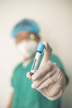 Coronavirus 2019 nCoV kan örneği. Corona virüsü salgını. Laboratuvardaki Corona Virüsü. Bilim adamları üzerinde kan testi olan bir tüp ve virüsün adı Coronavirus olan bir barkod tutuyor. Yeni Salgın Corona Virüsü