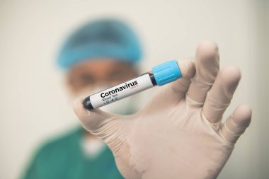 Coronavirus 2019 nCoV kan örneği. Corona virüsü salgını. Laboratuvardaki Corona Virüsü. Bilim adamları üzerinde kan testi olan bir tüp ve virüsün adı Coronavirus olan bir barkod tutuyor. Yeni Salgın Corona Virüsü