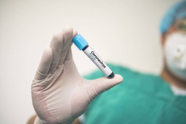 Coronavirus 2019 nCoV kan örneği. Corona virüsü salgını. Laboratuvardaki Corona Virüsü. Bilim adamları üzerinde kan testi olan bir tüp ve virüsün adı Coronavirus olan bir barkod tutuyor. Yeni Salgın Corona Virüsü
