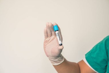 Coronavirus 2019 nCoV kan örneği. Corona virüsü salgını. Laboratuvardaki Corona Virüsü. Bilim adamları üzerinde kan testi olan bir tüp ve virüsün adı Coronavirus olan bir barkod tutuyor. Yeni Salgın Corona Virüsü