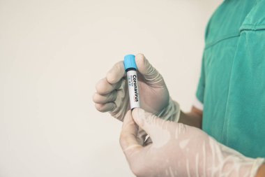 Coronavirus 2019 nCoV kan örneği. Corona virüsü salgını. Laboratuvardaki Corona Virüsü. Bilim adamları üzerinde kan testi olan bir tüp ve virüsün adı Coronavirus olan bir barkod tutuyor. Yeni Salgın Corona Virüsü