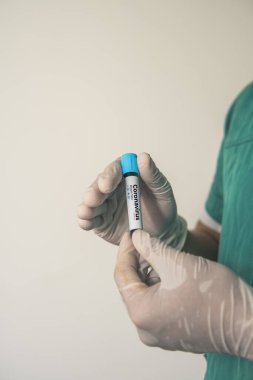 Coronavirus 2019 nCoV kan örneği. Corona virüsü salgını. Laboratuvardaki Corona Virüsü. Bilim adamları üzerinde kan testi olan bir tüp ve virüsün adı Coronavirus olan bir barkod tutuyor. Yeni Salgın Corona Virüsü