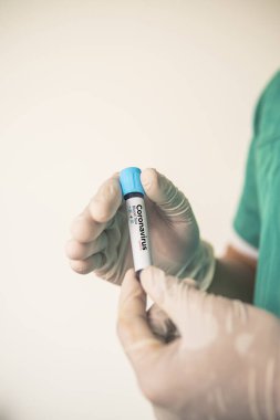 Coronavirus 2019 nCoV kan örneği. Corona virüsü salgını. Laboratuvardaki Corona Virüsü. Bilim adamları üzerinde kan testi olan bir tüp ve virüsün adı Coronavirus olan bir barkod tutuyor. Yeni Salgın Corona Virüsü