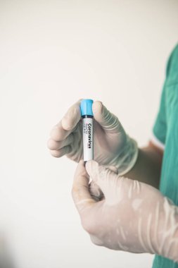 Coronavirus 2019 nCoV kan örneği. Corona virüsü salgını. Laboratuvardaki Corona Virüsü. Bilim adamları üzerinde kan testi olan bir tüp ve virüsün adı Coronavirus olan bir barkod tutuyor. Yeni Salgın Corona Virüsü