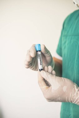 Coronavirus 2019 nCoV kan örneği. Corona virüsü salgını. Laboratuvardaki Corona Virüsü. Bilim adamları üzerinde kan testi olan bir tüp ve virüsün adı Coronavirus olan bir barkod tutuyor. Yeni Salgın Corona Virüsü
