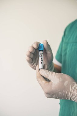 Coronavirus 2019 nCoV kan örneği. Corona virüsü salgını. Laboratuvardaki Corona Virüsü. Bilim adamları üzerinde kan testi olan bir tüp ve virüsün adı Coronavirus olan bir barkod tutuyor. Yeni Salgın Corona Virüsü