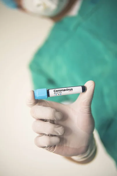 Coronavirus 2019 Ncov Δείγμα Αίματος Ιός Της Κορόνας Σπάει Ιός — Φωτογραφία Αρχείου