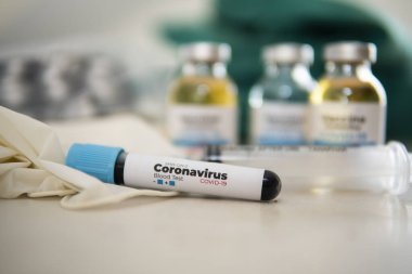 Yeni Corona virüsü enfeksiyonu (yeni Corona virüsü hastalığı 2019) teşhisi için pozitif COVID-19 testi ve laboratuvar örneği. Bulaşıcı salgın konsepti