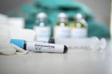 Yeni Corona virüsü enfeksiyonu (yeni Corona virüsü hastalığı 2019) teşhisi için pozitif COVID-19 testi ve laboratuvar örneği. Bulaşıcı salgın konsepti