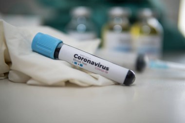 Yeni Corona virüsü enfeksiyonu (yeni Corona virüsü hastalığı 2019) teşhisi için pozitif COVID-19 testi ve laboratuvar örneği. Bulaşıcı salgın konsepti