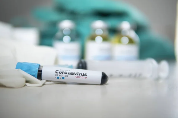 Положительный Тест Covid Лабораторный Образец Крови Диагностики Новой Коронной Вирусной — стоковое фото