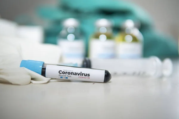 Положительный Тест Covid Лабораторный Образец Крови Диагностики Новой Коронной Вирусной — стоковое фото