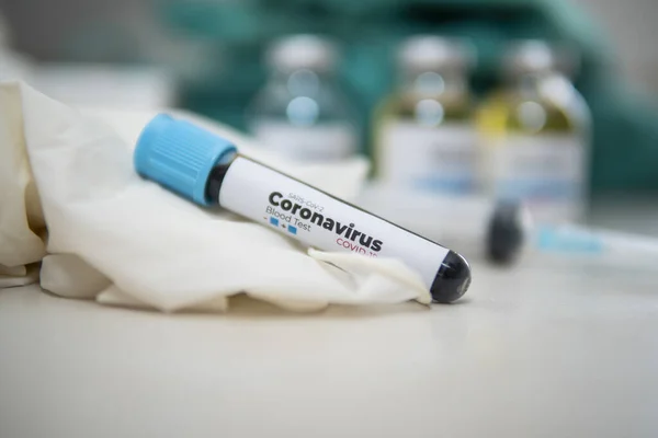 Covid 테스트 진단을 샘플새로운 코로나 바이러스 새로운 코로나 바이러스 2019 — 스톡 사진
