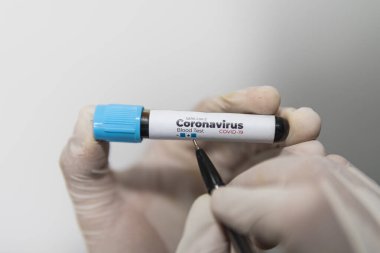 Antikorların eldiven giymiş bir laboratuvar asistanının ellerinde koronavirüs testi için kan örneği içeren test tüpü negatif bir işaret yazıyor. Beyaz kalemle izole edilmiş, yakın plan. Covid-19 konsepti.