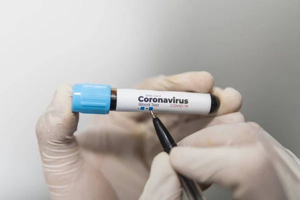 Testrør Med Blodprøve Teste Antistoffer Mot Coronavirus Hendene Laboratorieassistent Med – stockfoto