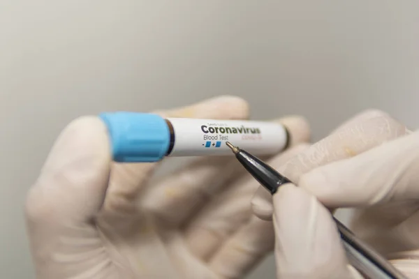 Testrør Med Blodprøve Teste Antistoffer Mot Coronavirus Hendene Laboratorieassistent Med – stockfoto