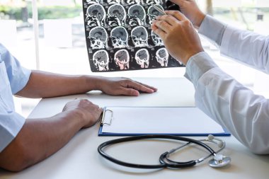 Doctor holding and looking at x-ray film examining at brain by c